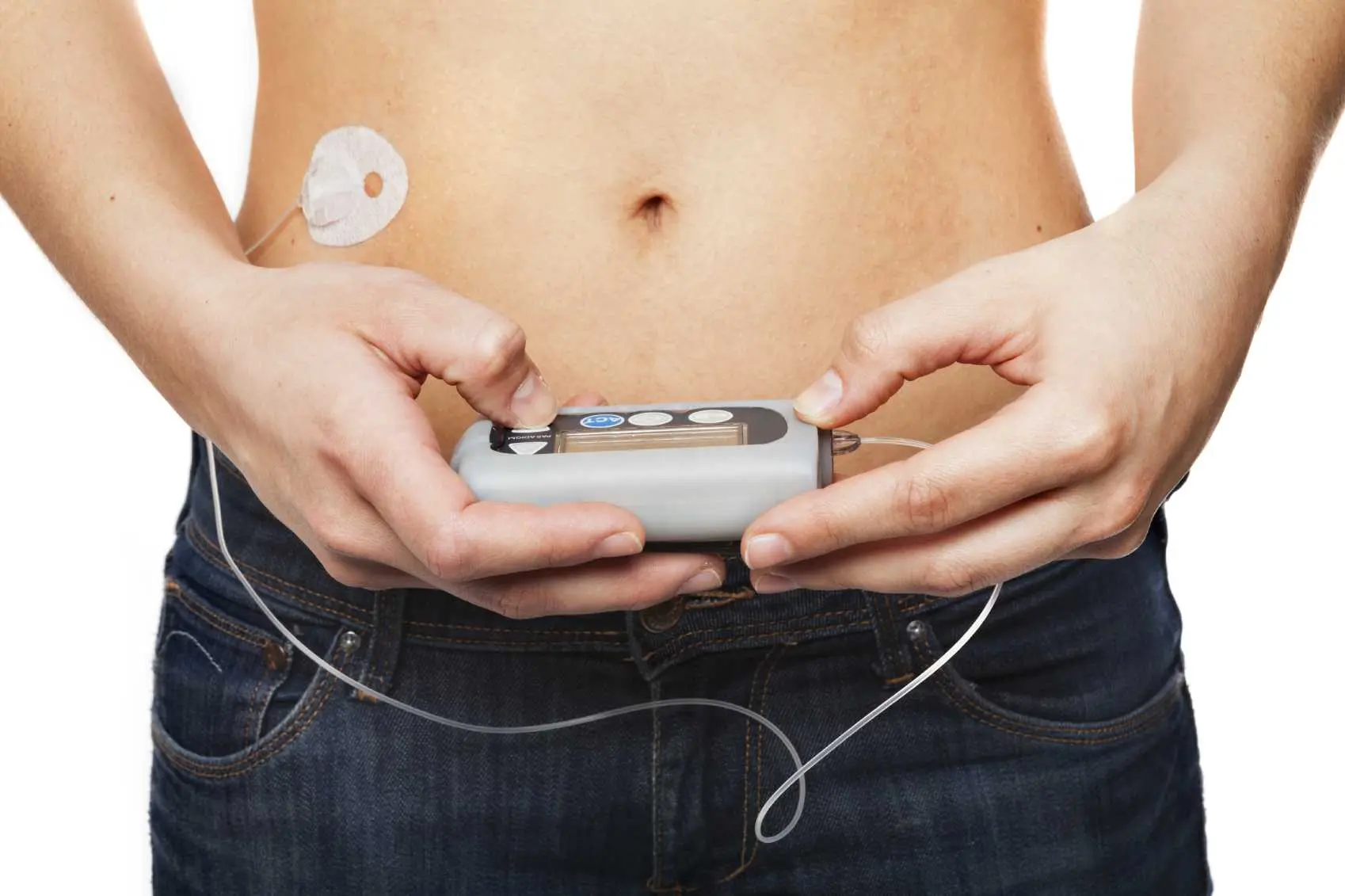 Type 1 diabetes: insulin pump, injections, blood glucose meters, etc.