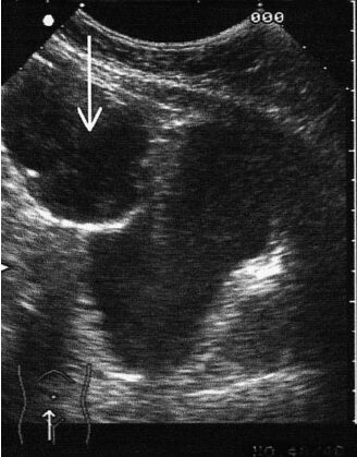 Ultrasound of the small pelvis in Samara