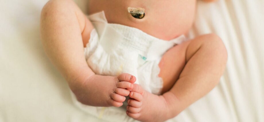 Umbilical cord in a newborn: when it falls off, on what day, a clothespin