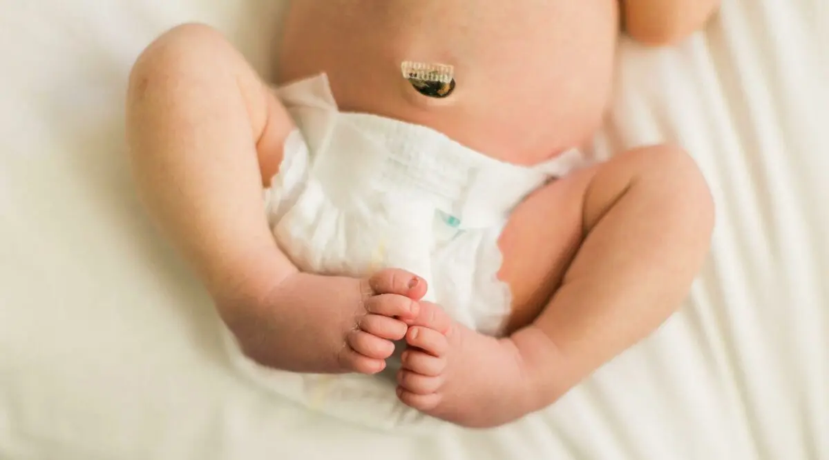 Umbilical cord in a newborn: when it falls off, on what day, a clothespin