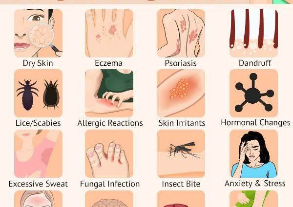 Understand everything about itchy skin