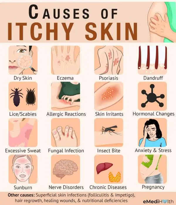 Understand everything about itchy skin