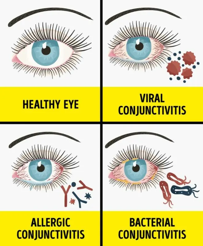 Unusual manifestations of allergies and how to treat them