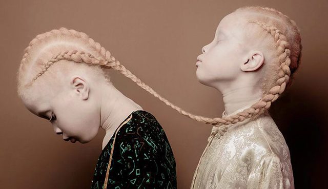 Unusual models, albino children in the modeling business