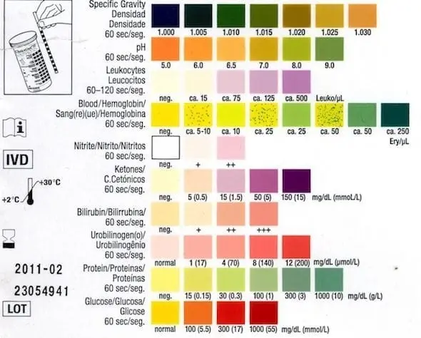 Urinary dipstick: what role during a urine test?