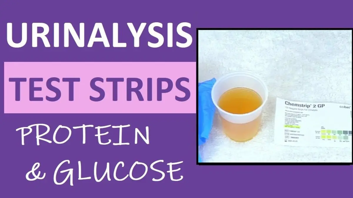 Urine analysis during pregnancy. Video