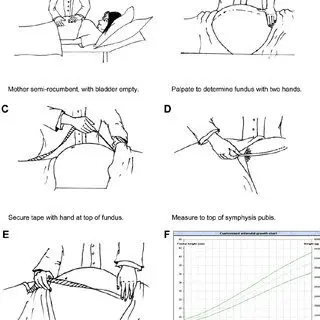 Uterine height: why measure it to monitor pregnancy?