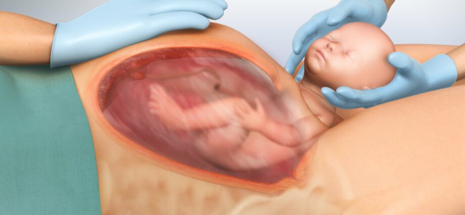 Uterus after childbirth: video