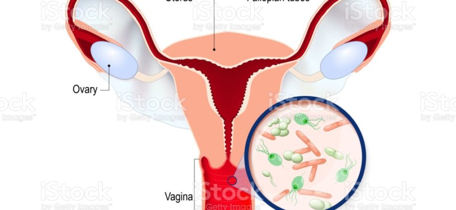 Vaginitis - Mjesta od interesa