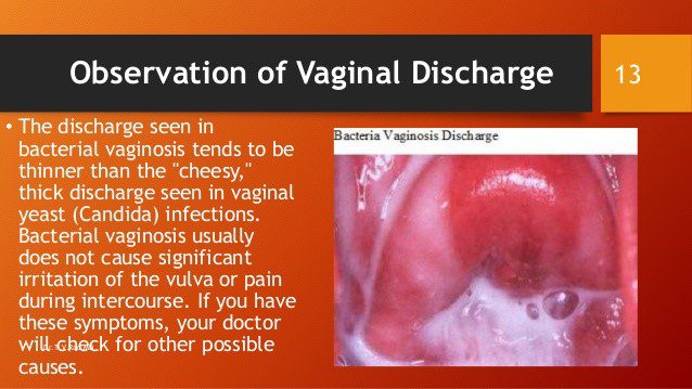 Vaginitis - vaginale infectie