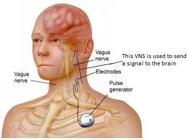 Vagus nerve