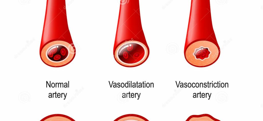 Vasoconstriction: when the blood vessels constrict