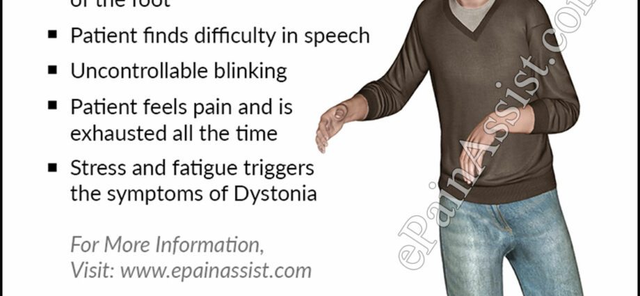 Vegetovascular dystonia does not happen and other myths about this disease