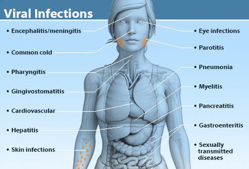 Viroze: veidi, simptomi un ārstēšana
