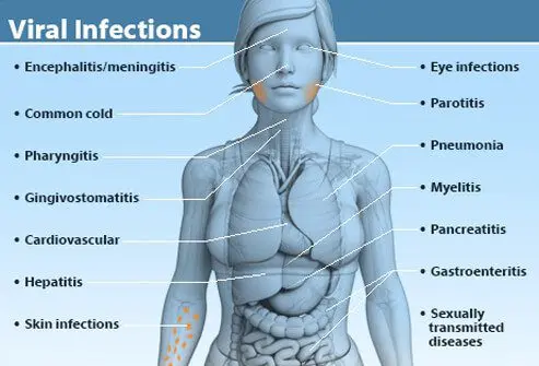 Virosis: types, symptoms and treatments