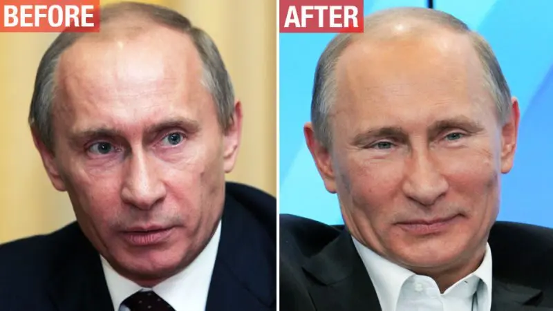 Vladimir Putin: botox is no stranger to men