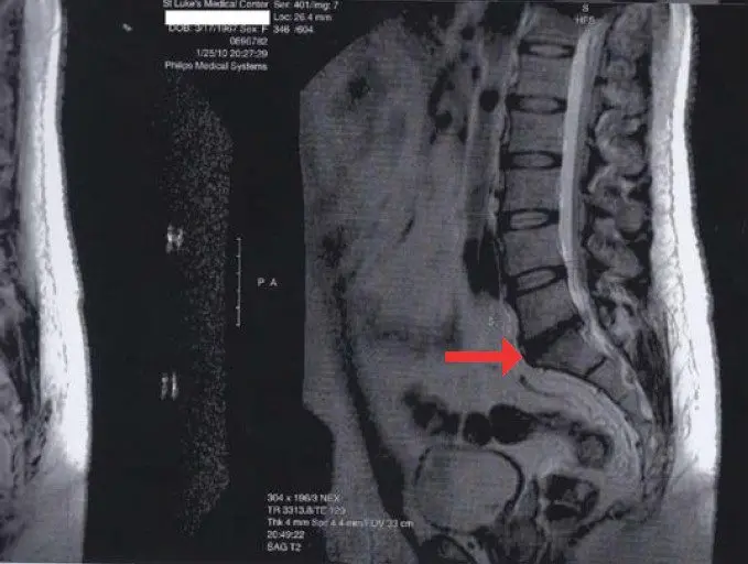 Volgograd &#8220;RCK FLY&#8221;, back pain, where back pain is treated spine,