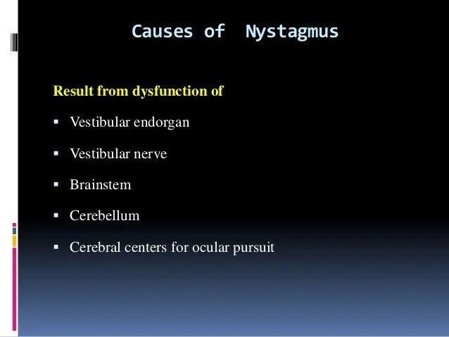 What are the causes of nystagmus?