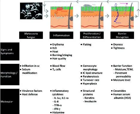 What are the complementary approaches to seborrheic dermatitis?