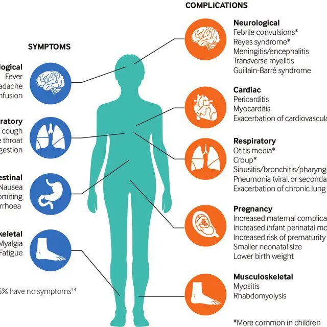 What are the complications from the flu?