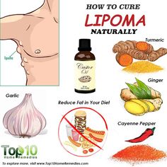 لیپوما کے علاج کیا ہیں؟