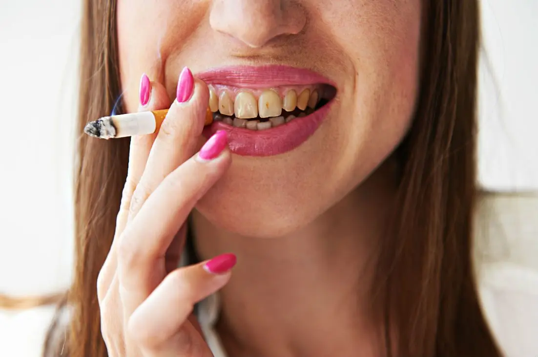 What Happens to a Smoker&#8217;s Teeth: Finding Out the Dentist