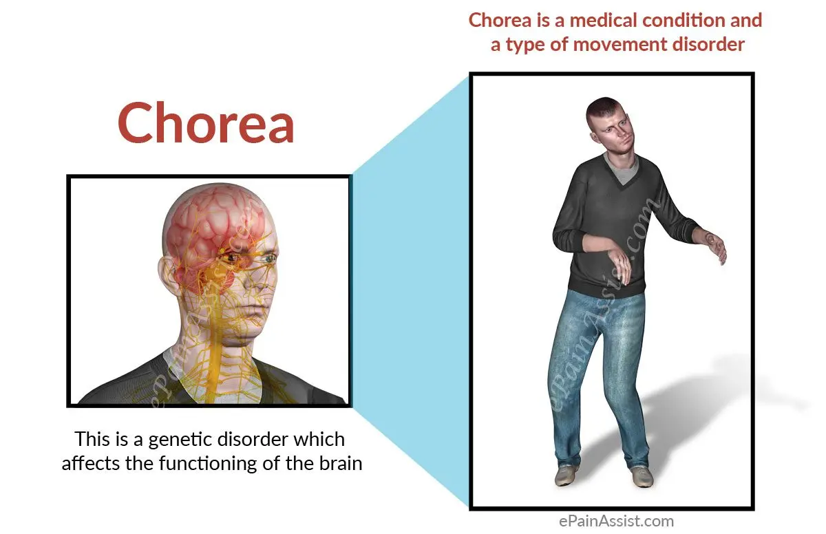 What is chorea?