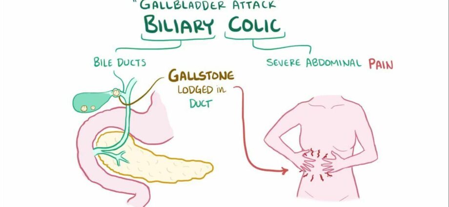hepatic colic ا آهي؟