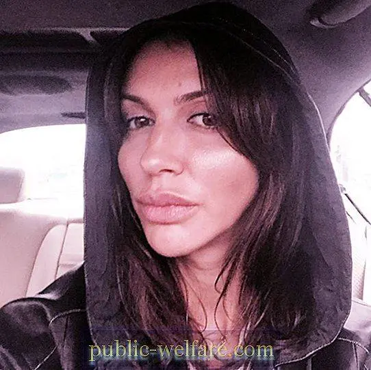 What is known about Alisa Kazmina&#8217;s illness, and why she should not have nose plastic surgery