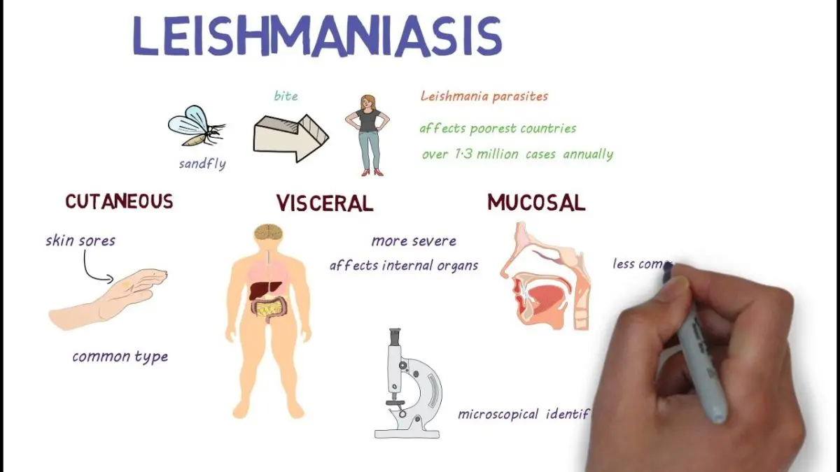 What is leishmaniasis?