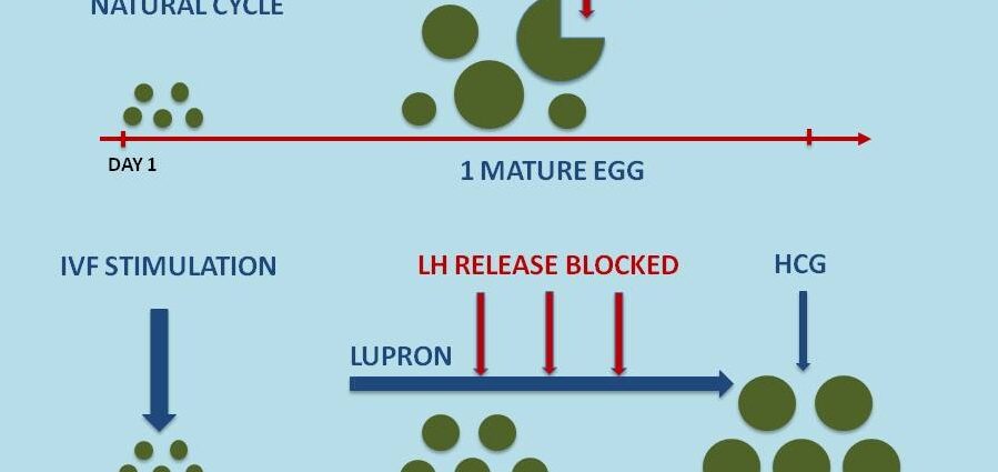 What is Ovarian Stimulation IVF Stages