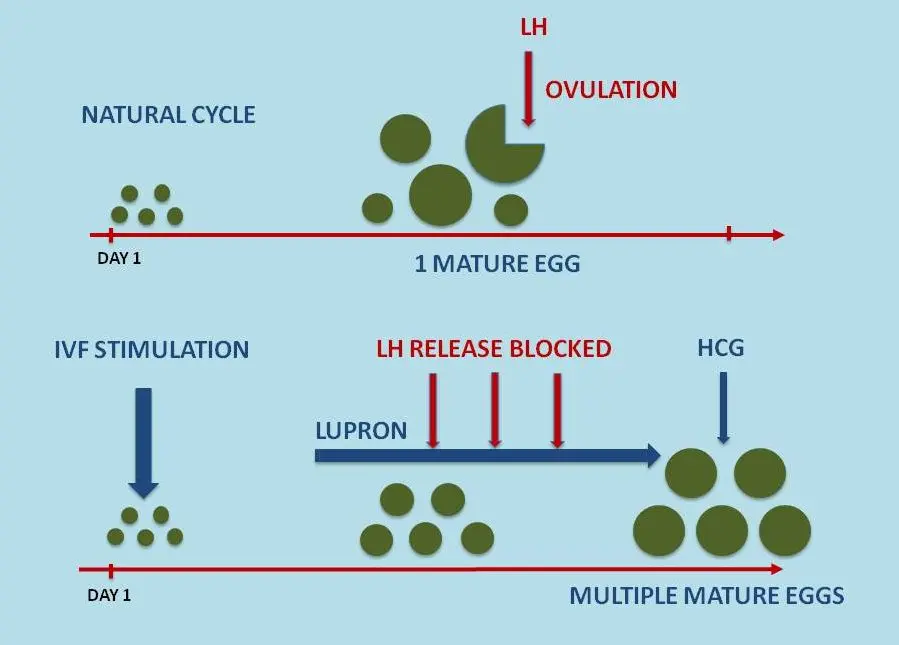 What is Ovarian Stimulation IVF Stages