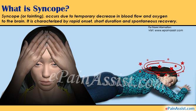 سنکوپ چیست؟