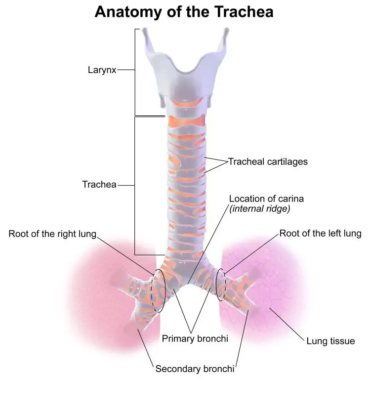 What is tracheitis?