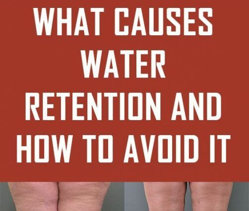 ¿Qué es la retención de agua?