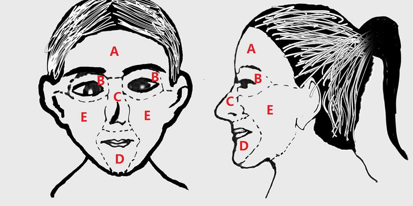 What makes the face or part of the face go numb