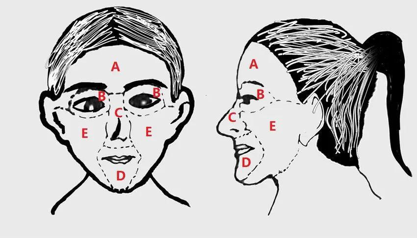 What makes the face or part of the face go numb