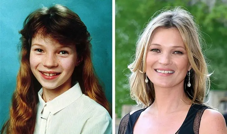 What supermodels looked like when they were teenagers