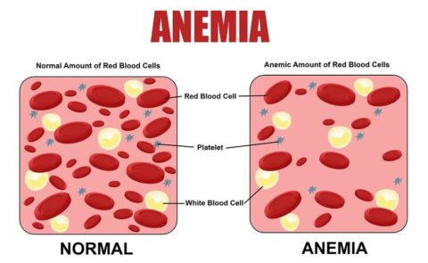 What to do if hemoglobin is elevated: simple tips