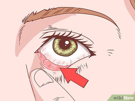 What to do if your eyes hurt: expert advice