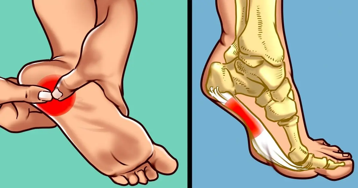 What to do if your heel is cracked and it hurts: folk remedies