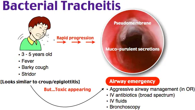 What treatments for tracheitis?