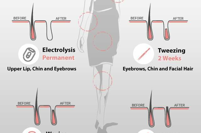 Which hair removal method to choose?