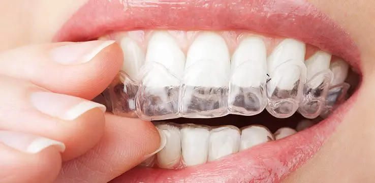 Whitening at home