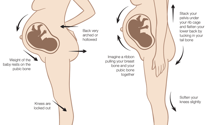 De ce stomacul și spatele pot răni în timpul sarcinii?