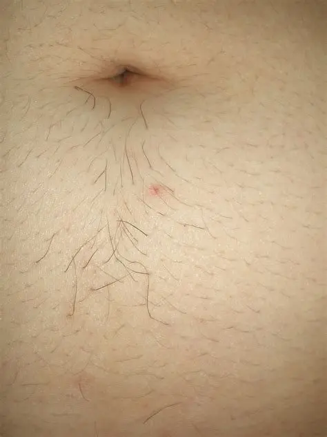 Why do girls have belly hair and how to remove it