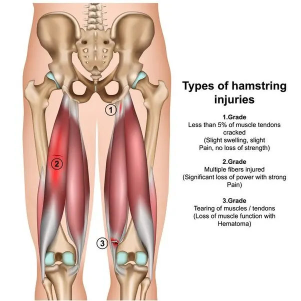 Why do legs hurt in the morning?