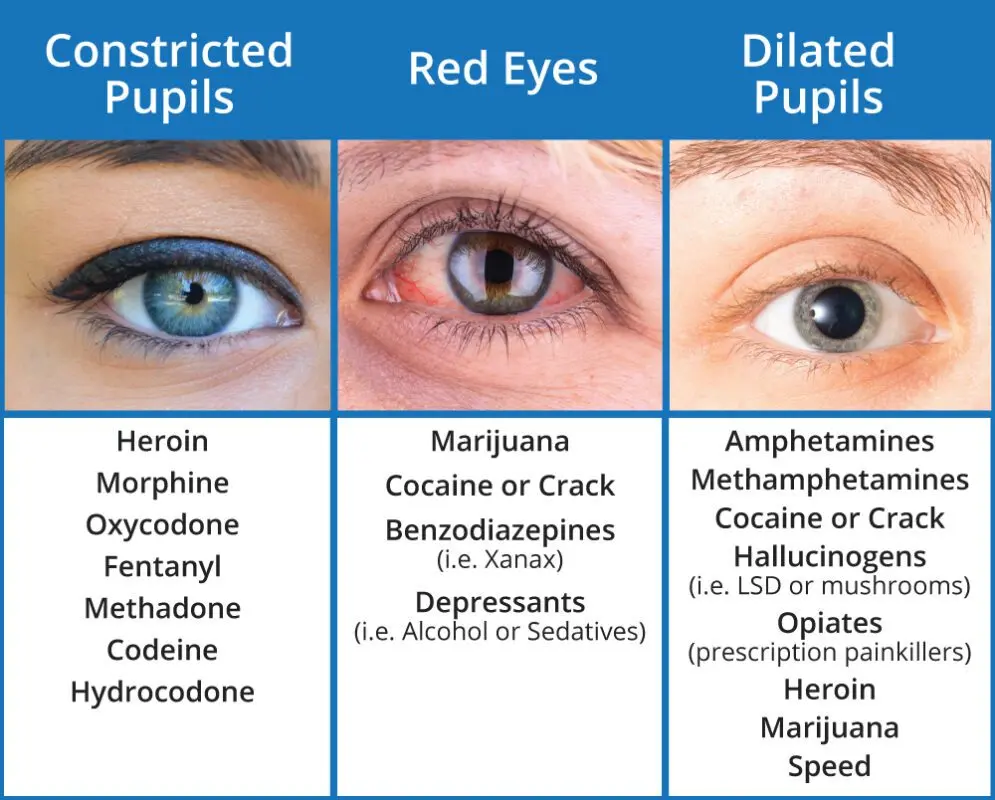 Why does a person have dilated pupils &#8211; the main reasons