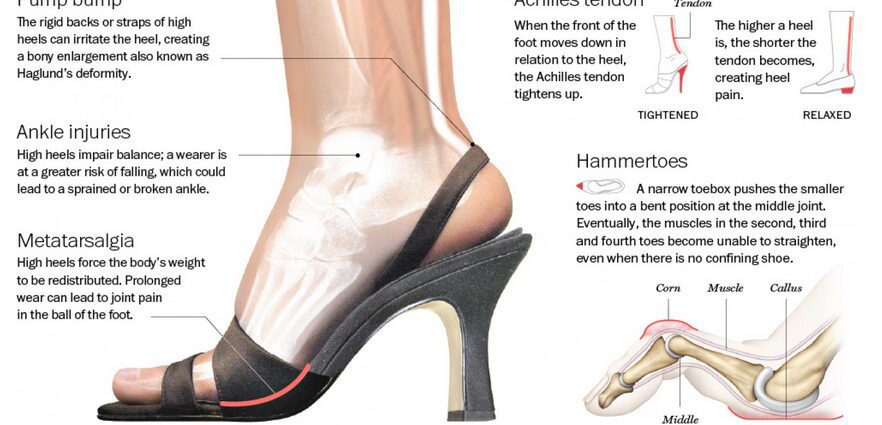 Why heels can hurt your head