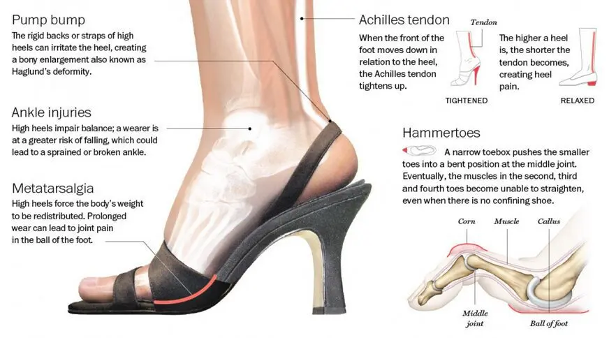 Why heels can hurt your head